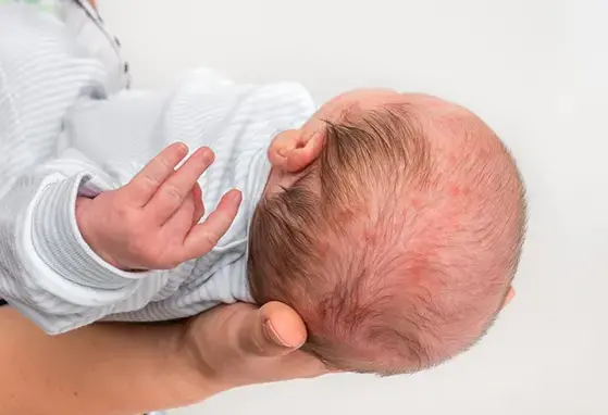 Rola modyfikacji mikrobioty w zapobieganiu chorobom alergicznym i ich leczeniu